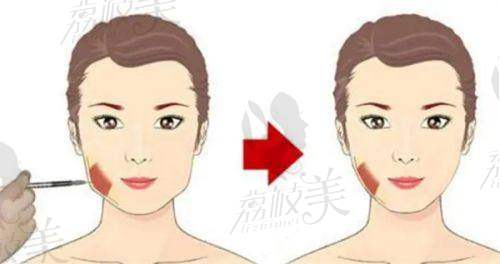 成都晶肤医疗美容连锁(天府长城院)怎么预约挂号？