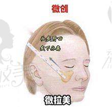 成都晶肤医疗美容连锁(天府长城院)口碑怎么样？