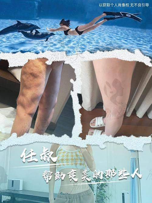 冯斌吸脂