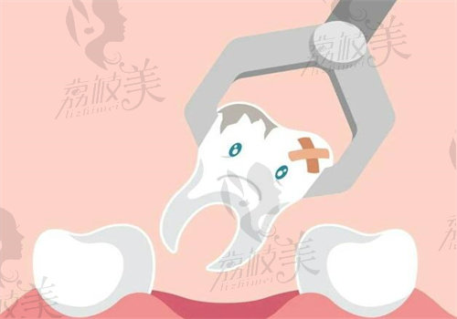 深圳中环口腔曾景量医生拔牙280元起，技术靠谱
