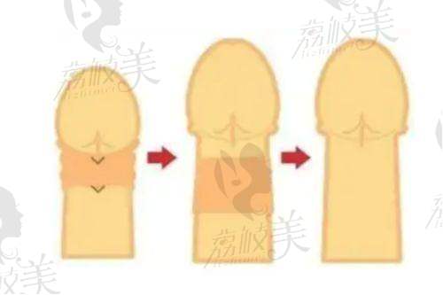 重庆松山医院罗会良：怎么预约？