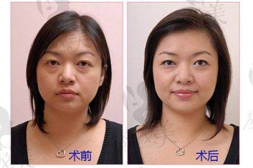 北京星洲医疗美容诊所怎么预约挂号？