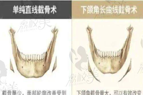 彭旭医生口碑怎么样？