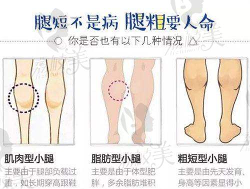 李跃军 医生口碑怎么样？