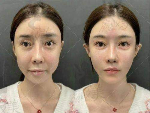 彭旭医生擅长项目：