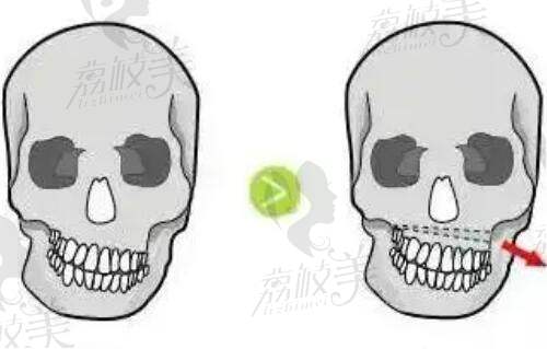 李跃军 医生怎么预约挂号？