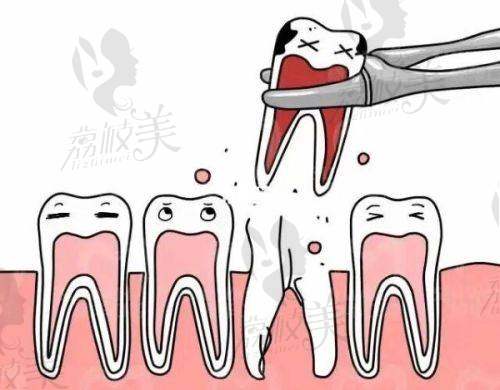 重庆团圆口腔医院补牙费用198起·价格刚刚好还贴心护齿又快又稳