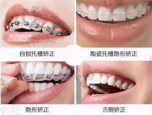 二、儿童地包天的危害