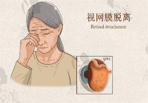 一、沂水光明眼镜诊所怎么样？