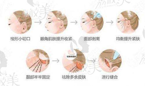 杭州星缇医疗美容诊所特色项目：