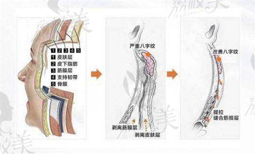 北京星洲医疗美容诊所特色项目：
