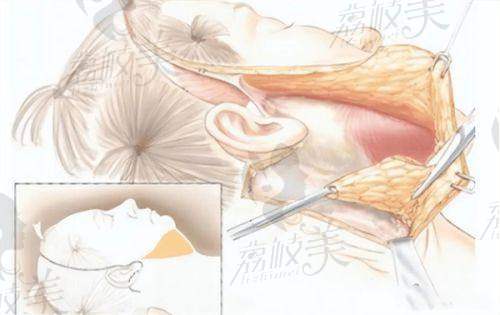 杭州星缇医疗美容诊所是正规的吗？