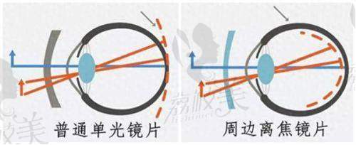 6. 沈阳军区总医院眼科收费标准如何？角膜塑形镜及药物治疗价格