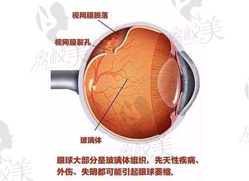 7. 长春一诺眼科优惠活动大揭秘