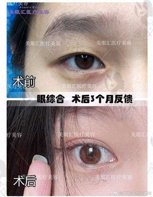 段艳军为什么只做眼鼻整形？不接脂肪填充和隆胸项目