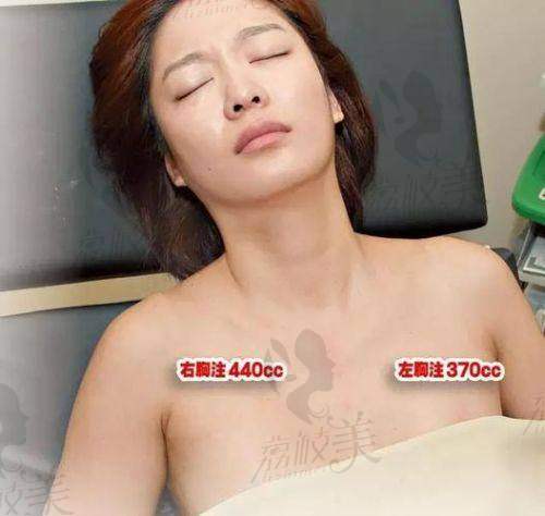 上海仁爱潘舒亚隆胸水平怎么样