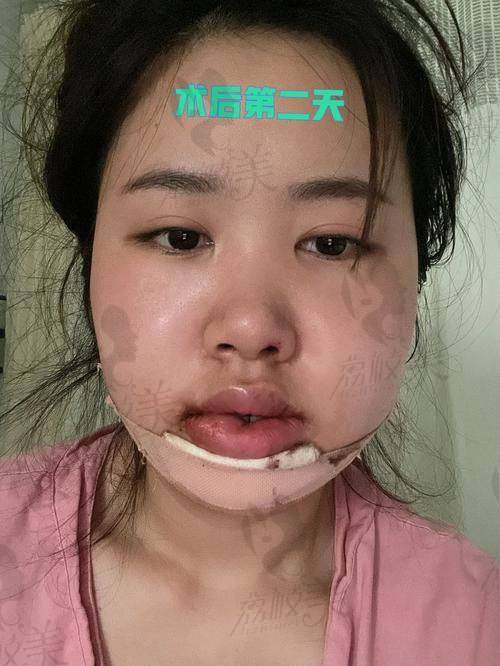 肖林医生，重庆松山医院正颌界的台柱子选他错不了