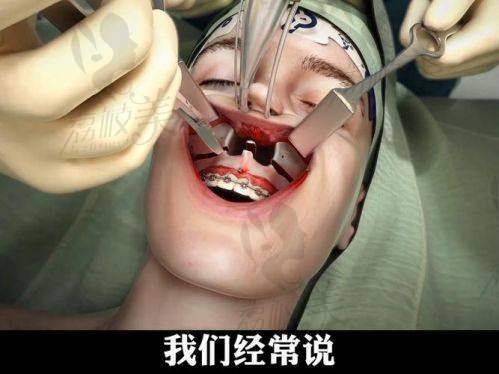 重庆本地人都选哪儿做正颌？当然还是重庆松山医院！