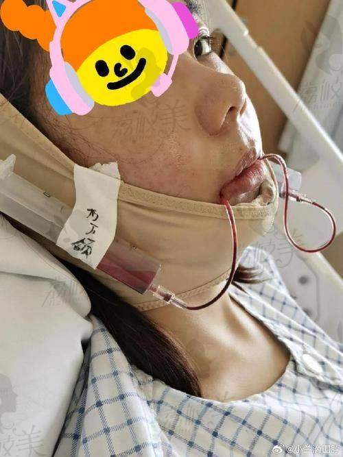 重庆松山医院整体实力如何？为何敢做这么高阶的正颌整形？
