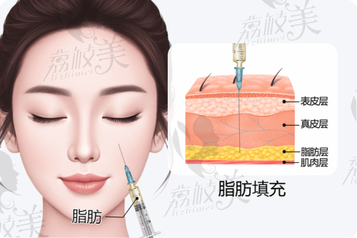 广州军美王世虎最擅长什么？答案揭晓：他在脂肪项目上造诣非凡！ 