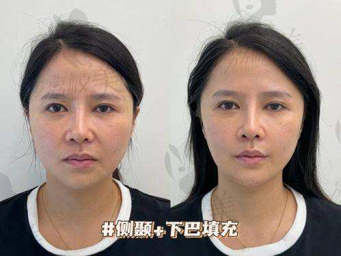 军美王世虎在脂肪项目上的未来发展方向是什么？