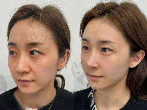 迟毓琦医生口碑怎么样？