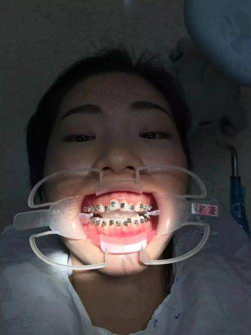 黄亚男医生擅长项目