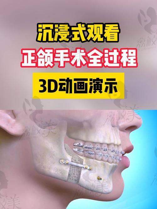 李自力坐诊哪个院区？知道这个能帮你少等8个月！