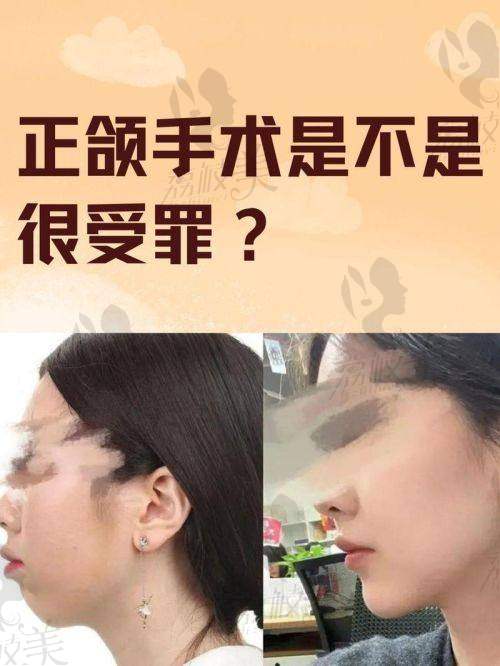 术前做到这几点，成功几率+50%