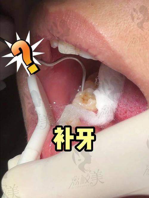 曾景量医生擅长项目怎么样？