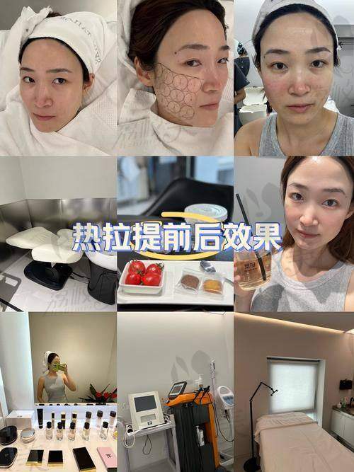 西安熱瑪吉官方認證的醫(yī)院名單公布啦！5家正規(guī)機構對比+2025最新價格解析