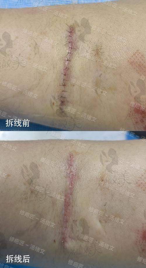 重庆杨东运怎样预约？微信、电话、官网等多途径预约攻略大揭秘！