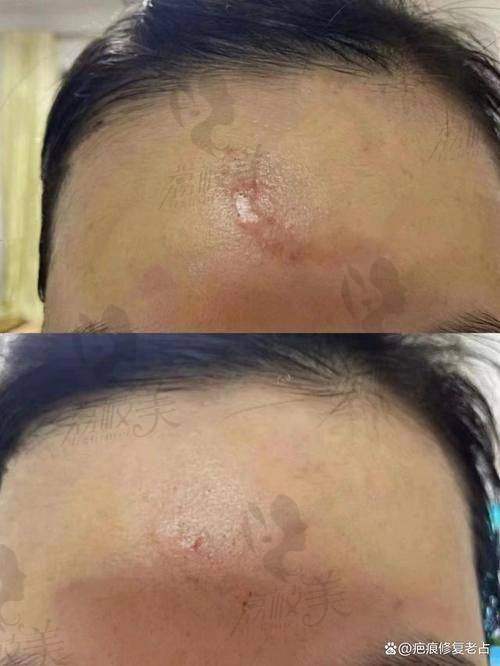 杨东运医生擅长项目及费用区间参考,小心不被信息差坑到