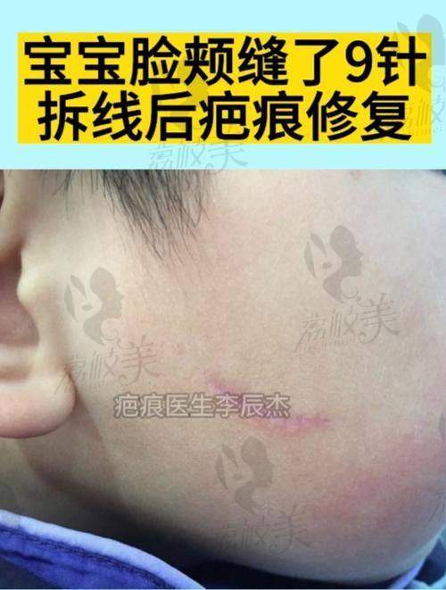 现场预约门诊有名额限制?了解号源分布特别重要!
