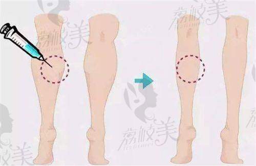 周口一美医疗美容门诊部口碑怎么样?