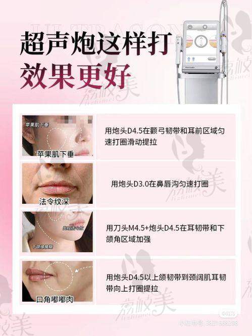 徐美玲医生怎么预约挂号？