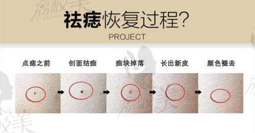 代磊医生怎么预约挂号?