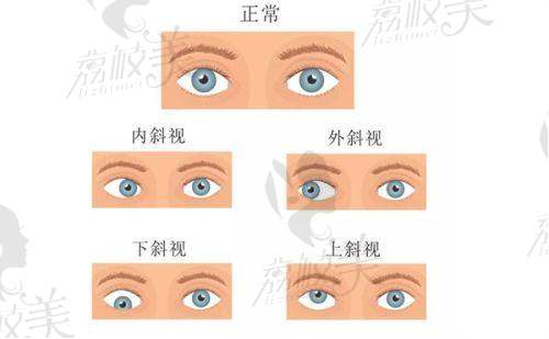 马宇医生擅长项目