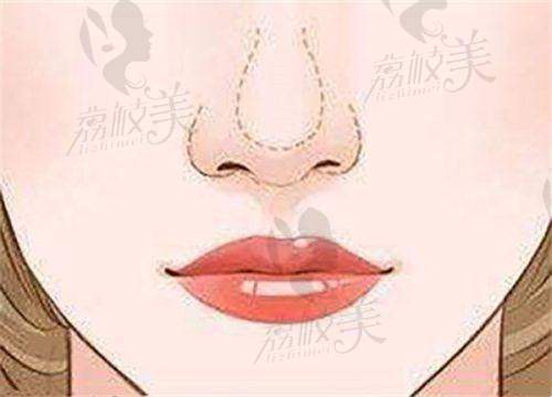 代磊医生擅长项目: