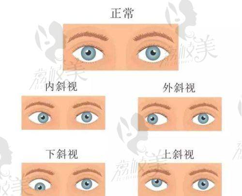 马宇医生技术特点
