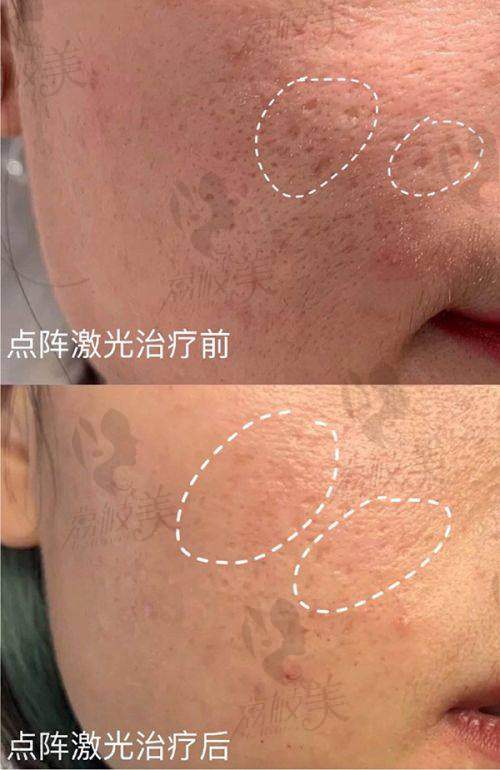6. 九龙医院男科检查多少钱？其他手术价格