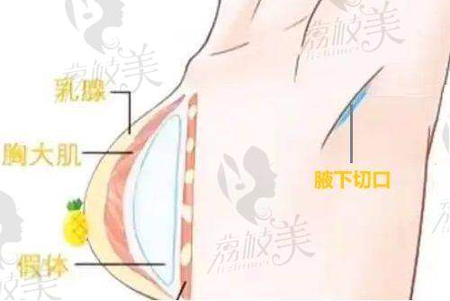 南方医 科 大学珠江医院整形美容科特色项目: