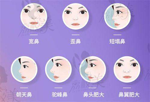 广州丽合整形医院的技术实力