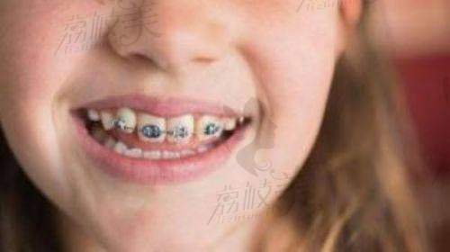 徐州中牙口腔医院是正规的吗？