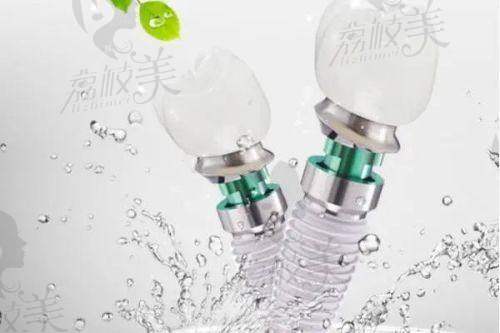 4. 2026深圳地区种植牙多少钱？瑞士ITI种植牙价格探秘