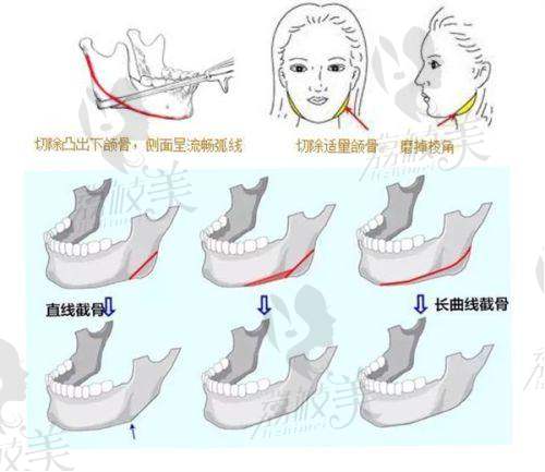 北京米兰柏羽丽都医疗美容医院除皱：个性化的治疗方案
