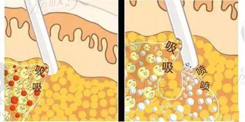 广州丽合整形医院的服务项目