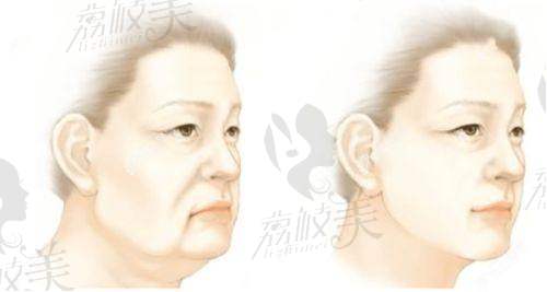 南方医 科 大学珠江医院整形美容科地址及乘车路线: