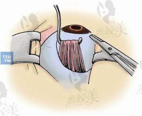 郑帆医生怎么预约挂号?