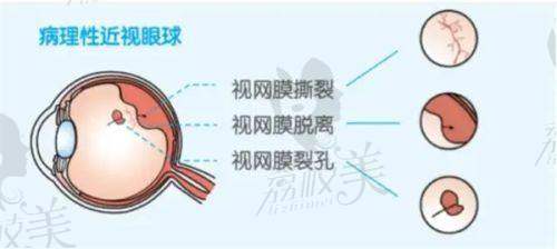 福州市第二医院眼科怎么样?